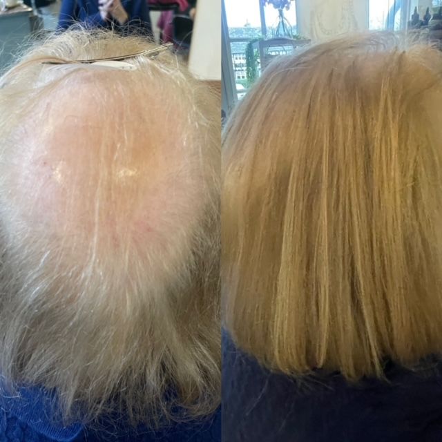 Before and after extensions added for thickness, Cezala Billingshurst